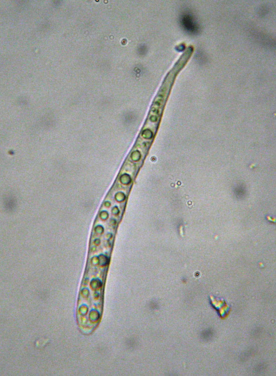 Forse non � Hymenoscyphus fructigenus ....